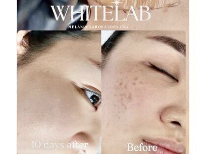 リアンドハリ(Rien’d Hari)の写真