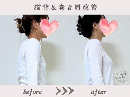 エーアール(AR)の写真