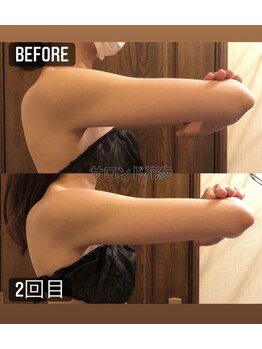 サロン ド 花歩 松山本店/痩せにくい二の腕もこの通り！