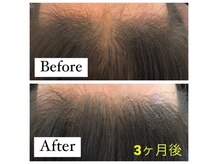 フェリーチェ 富山店/一日でも早く！