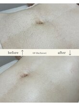 オフオルファヴォリ(OF Olu:Favori)/【フラッシュワックス脱毛】