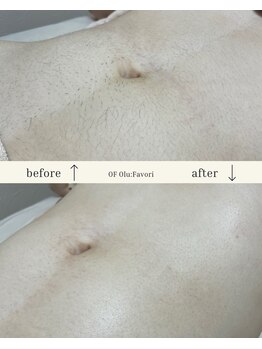 オフオルファヴォリ(OF Olu:Favori)/【フラッシュワックス脱毛】
