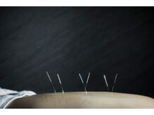 デルタエヌピー63+(δnp63+)/お客様施術例【小顔/薬院/福岡】