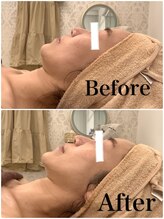 スペチアーレ 夙川/引き上がり効果抜群♪