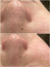 ヒルナム(Heal Nam)/~プロセルセラピーズお顔~