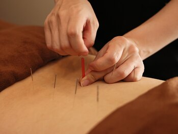 ハリラックス(HA:Ri/LAX)/【身体鍼灸の様子】