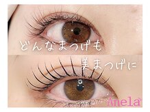 アネラ 土浦(Anela)の雰囲気（カウンセリングを重視しています。なんでもご相談ください。）