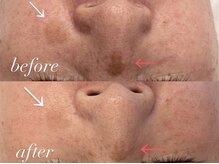 ミランサ ギンザ(MIRANSA GINZA)/リアボーテ化粧品半年使用の変化