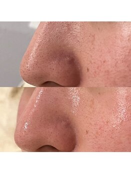 サロンアヌエヌエ ポノサロン(SalonAnuenue×pono_salon)/