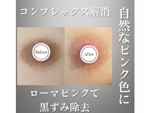 サロンドゥルシェル(salonde_le ciel)の雰囲気（話題のローマピンクが、40%offで施術可能♪一度の施術でOK！！）