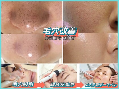 パルテールの写真
