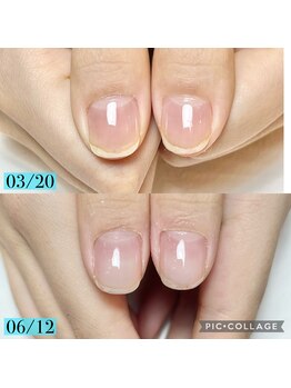 シャルム 本厚木(charme)/自爪育成ジェルコース