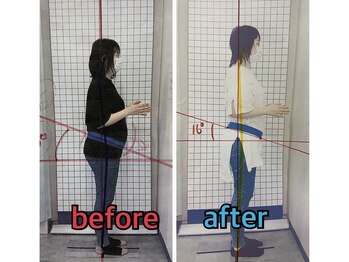 たけだ整骨院 手稲/30代女性ビフォーアフター
