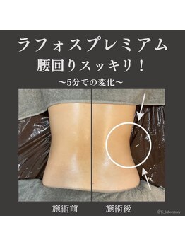 ラボラトリー バイ イー 麻布十番店(laboratory by E)/ラフォスプロ（上半身）