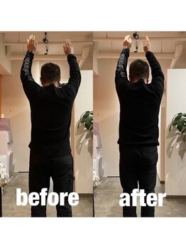 カワル整体 上通り院/【肩こり影響が肩の可動域にも】