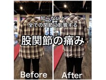 カワル整体 上通り院/知っておくべき股関節解説