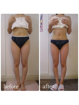 加圧ビューティーサロン スタイル エム(beauty salon style M)/20代/加圧×パワーツリー120分