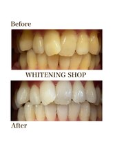 ホワイトニングショップ 葵区静岡駅店/ホワイトニング店ホワイトニング