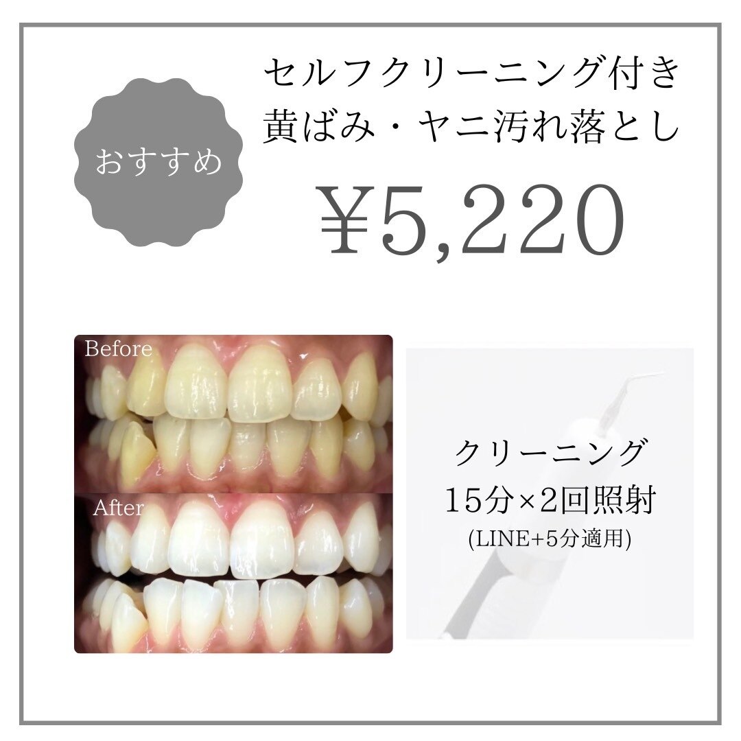 【心斎橋・本町】本気で白さ実感☆Wホワイトニング＋クリーニング\5,220