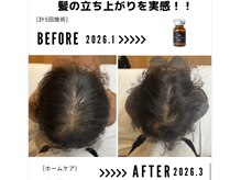 サンシー整体(SunCY整体)/４０代女性