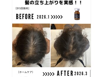サンシー整体(SunCY整体)/４０代女性