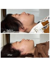 美容整体サロン プライム(Prime)/小顔矯正　ビフォーアフター