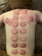 リベル(Liber)/お疲れのお体をデトックスケア