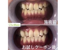 ルブラン 奈良店(Le Blanc)/納得いくまで頑張りませんか？？