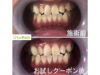 ルブラン 奈良店(Le Blanc)/納得いくまで頑張りませんか??