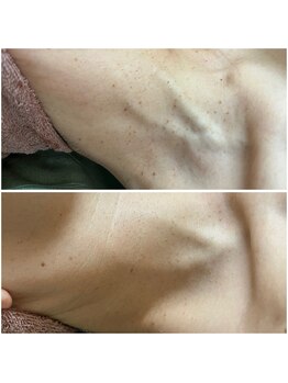 カヌヌ(Kanunu)/首トラブルケア