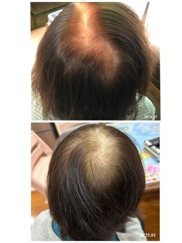 ヒルナム(Heal Nam)/プロセルセラピーズ~頭皮~