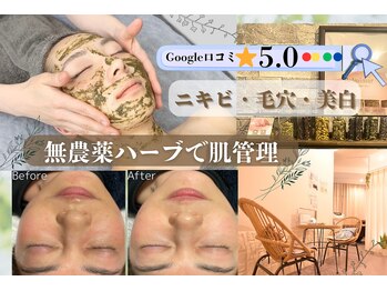 ベルミマール(BELMIMAR)