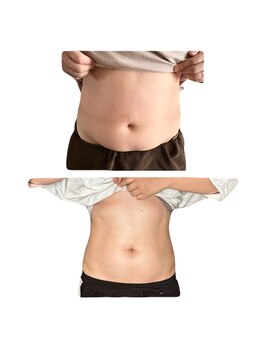 絢香/腸もみ10回