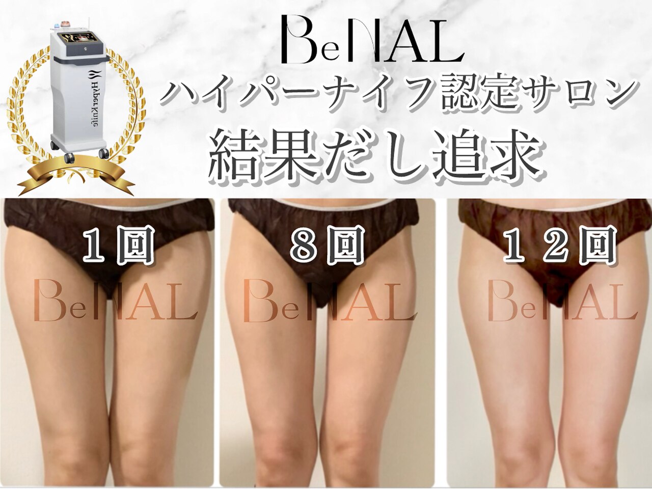 ビナル(BeNAL)｜ホットペッパービューティー