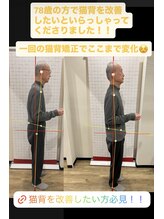 ホネツギ 柏駅西口接骨院(HONETSUGI)/【猫背矯正】before/after