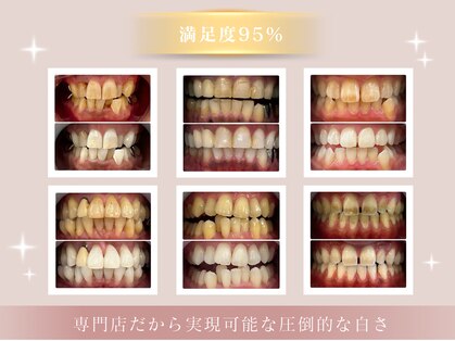 ホワイトニングショップ 蕨店の写真