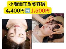 ウルハ鍼灸院(URUHA鍼灸院)の雰囲気（小顔矯正&美容鍼1,500円！【神戸/三宮駅/春日野道/小顔矯正】）