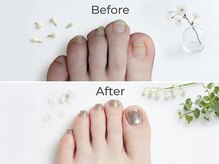 エーケーネイル(AKnail)の雰囲気（巻き爪でもフットジェルが出来ます）