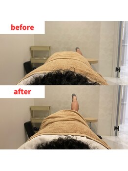 ナオル整体 福岡香椎院(NAORU整体)/30代男性施術事例【骨盤矯正】