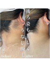 セリー(Celie)/お客様症例