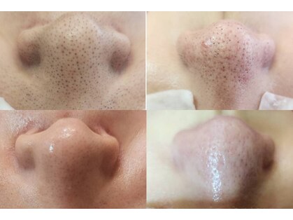 アナシアビューティーサロン(Anacia)の写真