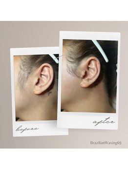 ブラジリアンワキシング シックスナイン(BrazilianWaxing69)/女性 / もみあげ