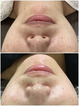 アイズ 横浜店(ize)/