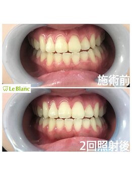 ルブラン 奈良店(Le Blanc)/おかえりなさいませ!