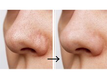 パルファムの雰囲気（いちご鼻は吸引機で解消！毛穴洗浄は大人気、美肌も美眉もGET）