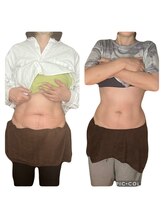 絢香/腸もみ3回