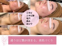 プレジール(plasir)