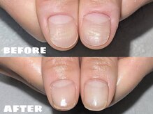 サロンペペ(salon pepe)の雰囲気（甘皮の荒れが整い、皮膚も健康に。育成で縦長の爪へ変化）