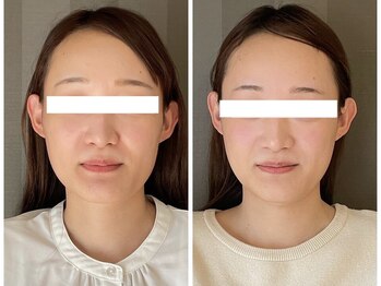 ソルビーフェイス(SOL*BeFace)/ブライダルフォトから結婚式へ