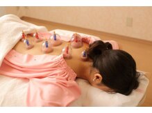 メイロン(meilong)/カッピング